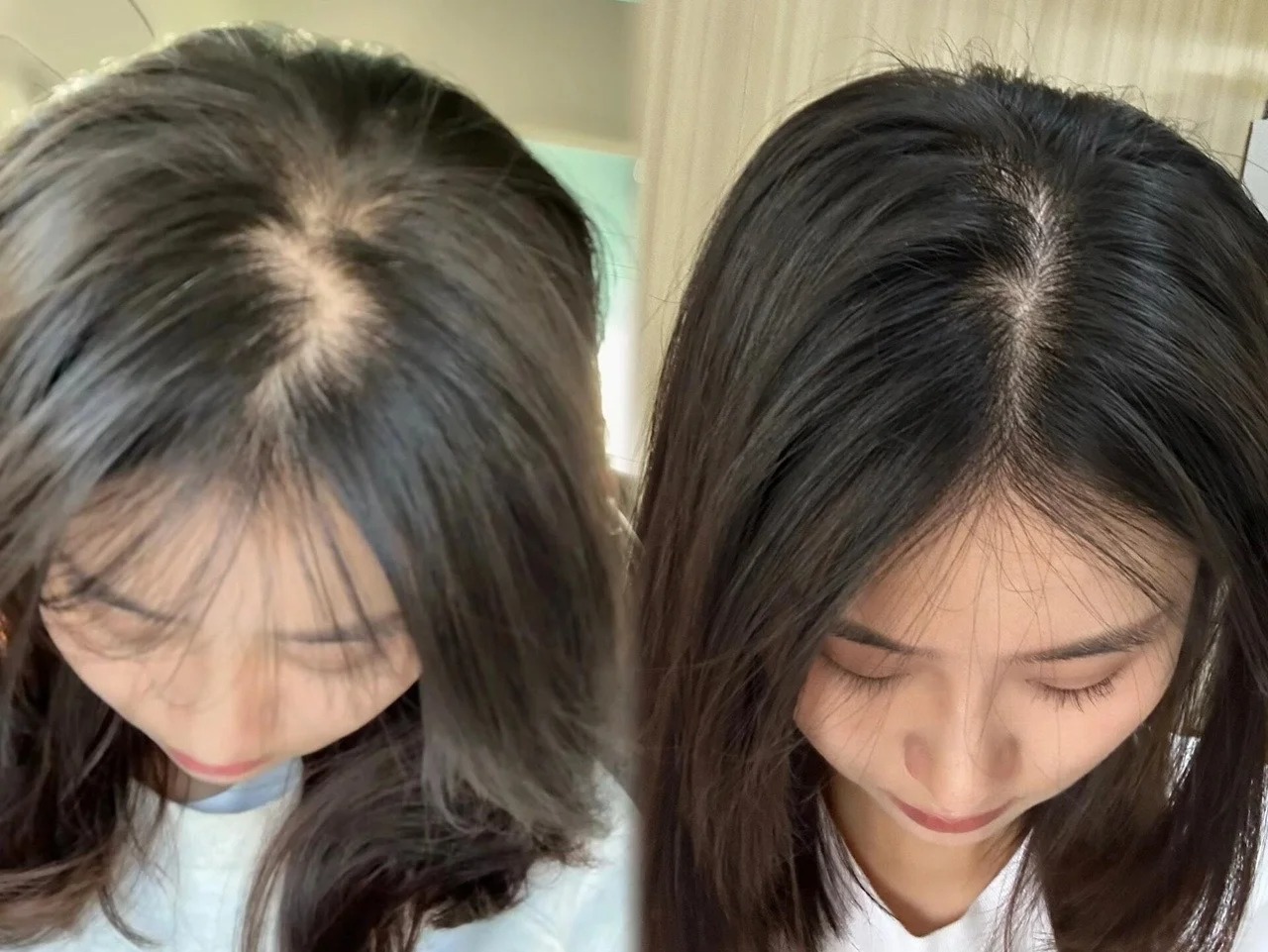 王女士使用效果