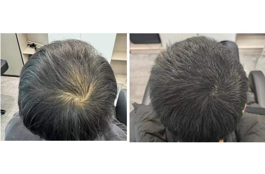 张先生使用效果