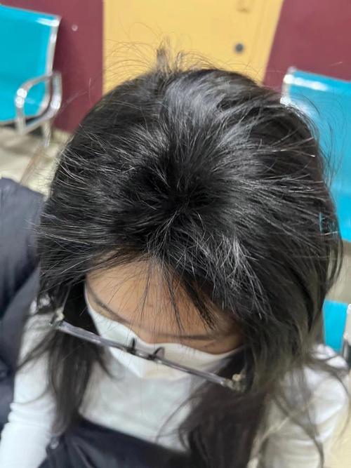 踩坑无数才总结：这些生发液使用误区别碰，IUTANA健发液使用注意事项快码住