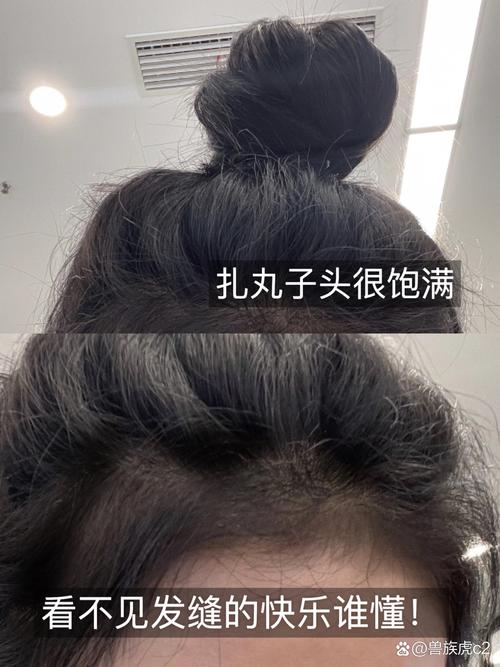 IUTANA 健发液测评：防脱生发、强韧发根、改善发际线