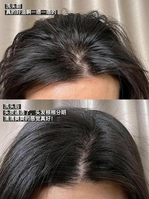 头油头痒总反复？IUTANI氨基酸洗发水深层洁净，控油清爽久到惊喜