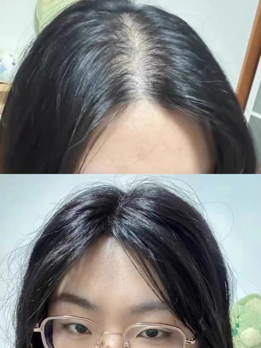 IUTANA健发液深度成分解析：终于明白为什么别人用生发液真的有用
