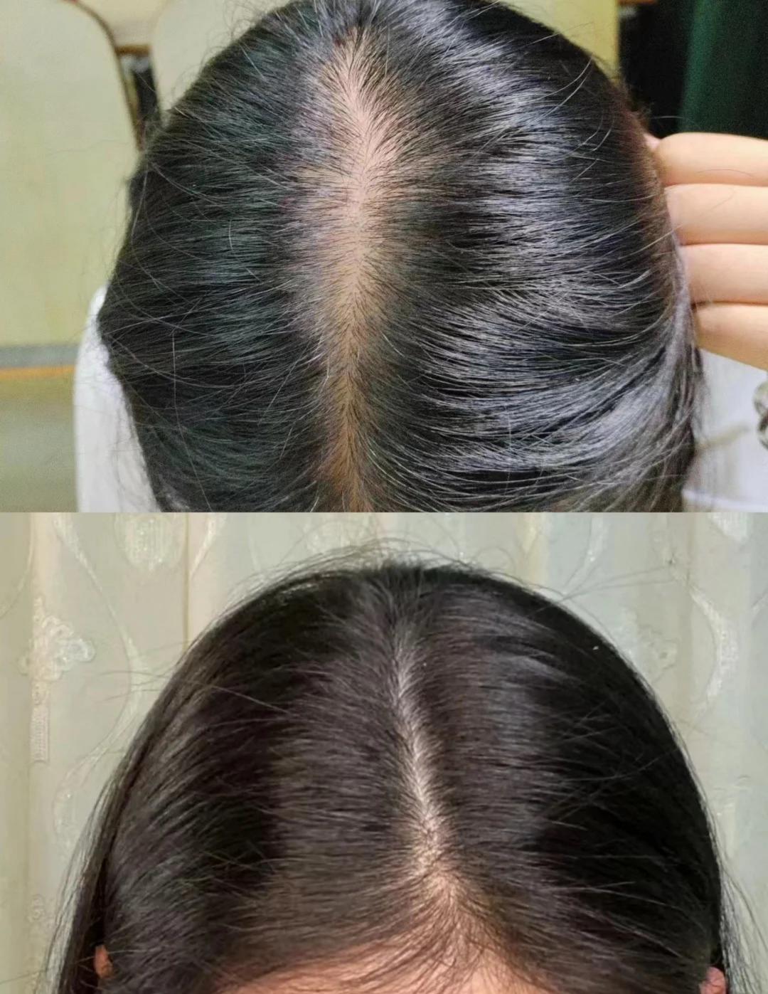 23➡️24年头发记录_1_JS25_来自小红书网页版.jpg